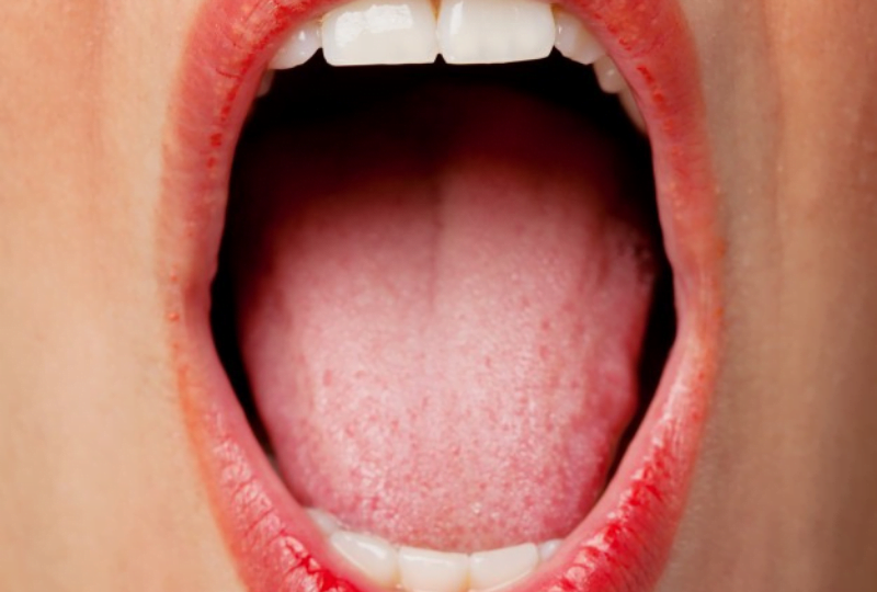 dry mouth affects on oral health