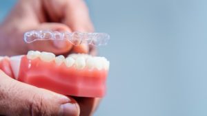 benefits of invisalign