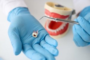 symptoms of root canal infection