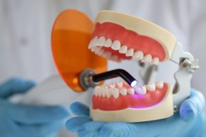 benefits of dental inlays & onlays