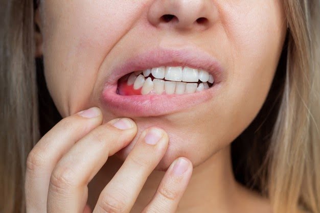 gum disease carstairs. Periodontal diseases dental care in carstairs alberta