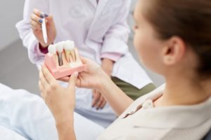 how to take care of your dental implants