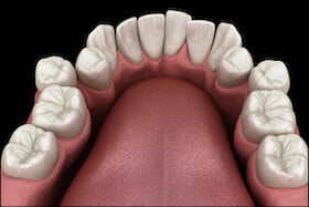 Crooked Teeth Dentist Carstairs Dental Alberta