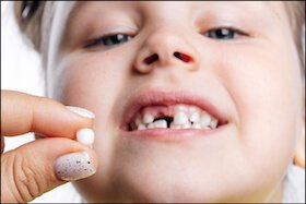 Early, Late, Or Irregular Loss Of Baby Teeth