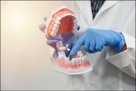 Missing Or Extra Teeth Dentist Carstairs Dental Alberta