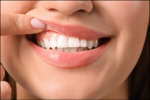 Treatment of gum Dentist Carstairs Dental Alberta