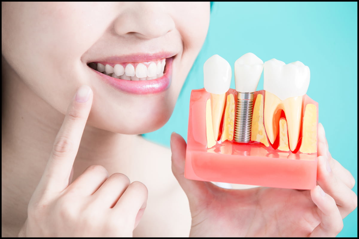 Dental Implants Carstairs dentist