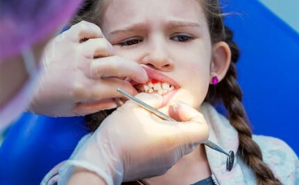 Children Gum Disease