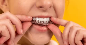 Fix Underbite with Invisalign Clear Aligners by an Invisalign Dentist