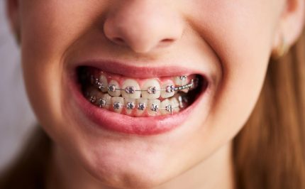 Pediatric Dentistry Orthodontics